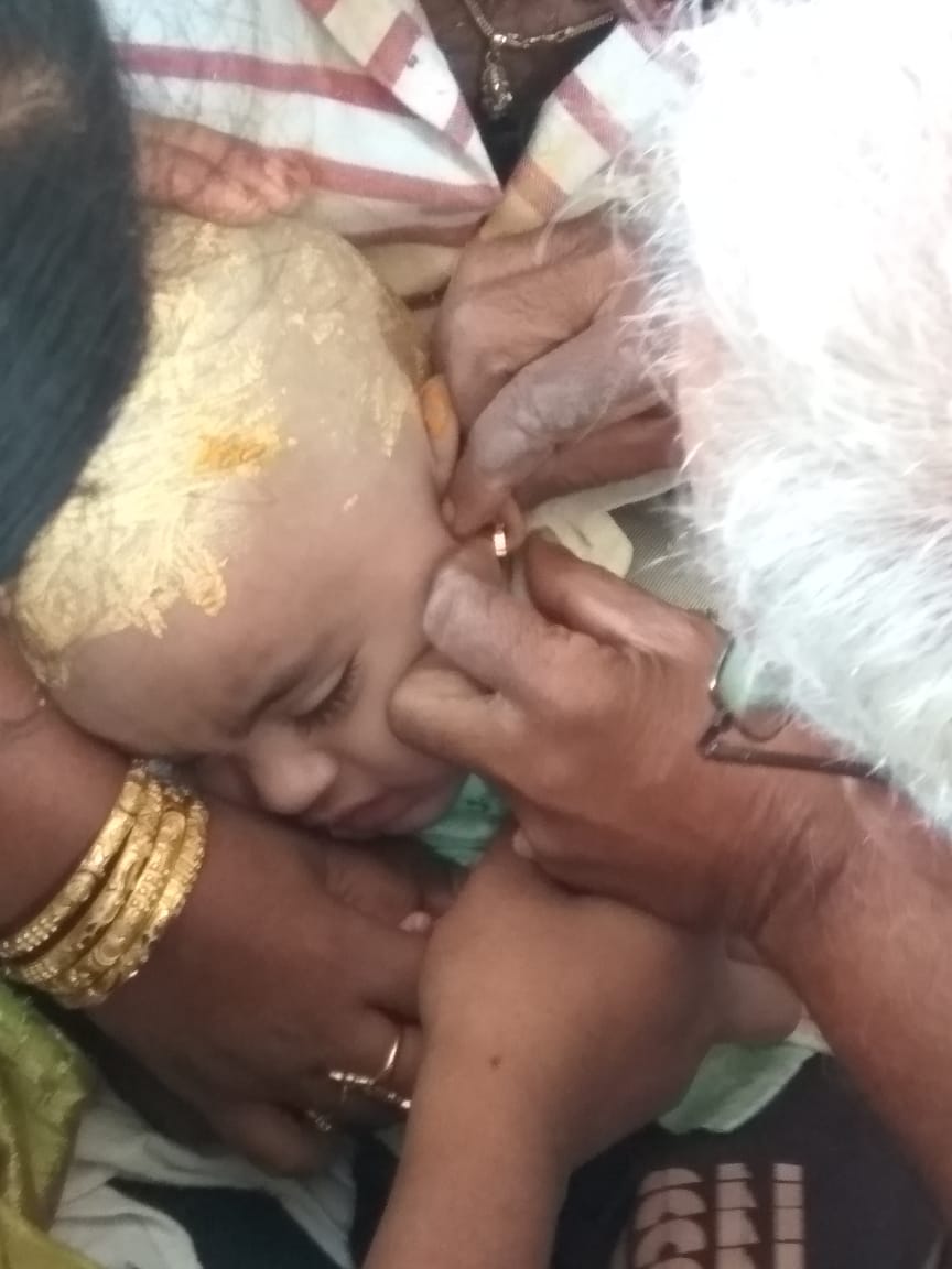 Baby ear piercing function