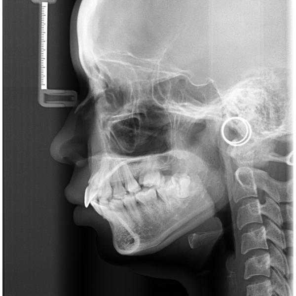 blog jewelry lifestyle medical xray edited