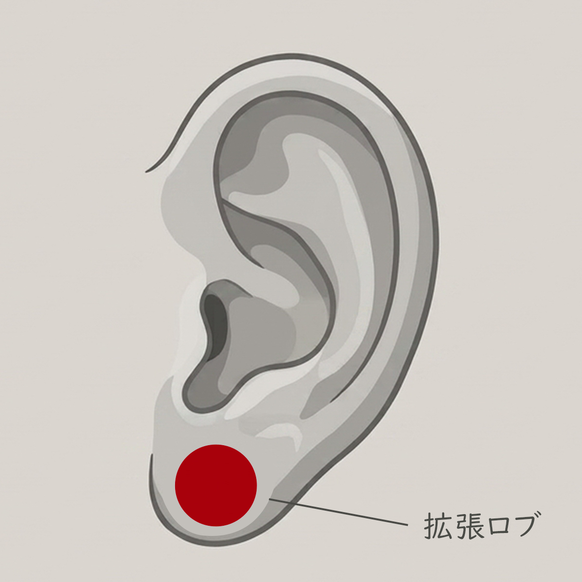 拡張ロブ