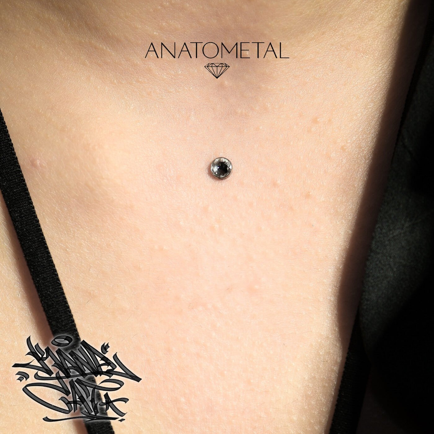 Anatometal Surface Ancour