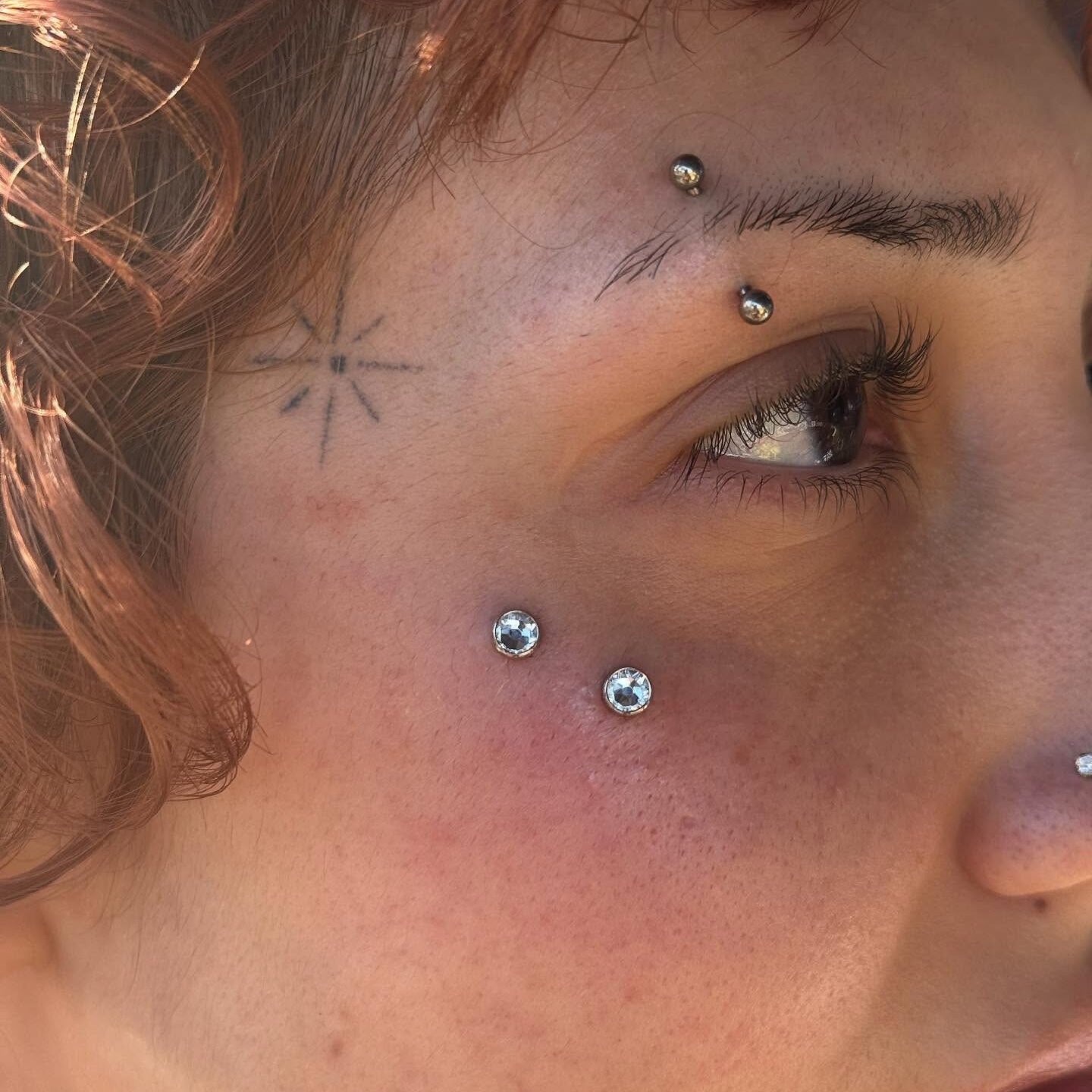Anatometal Surface Bar