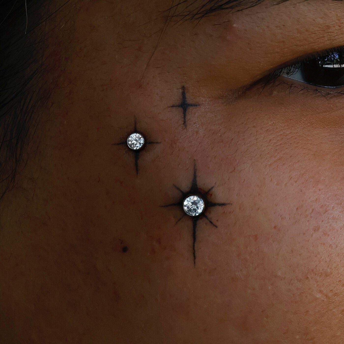 Anatometal Surface Bar